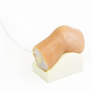 Arthrocentesis Knee
