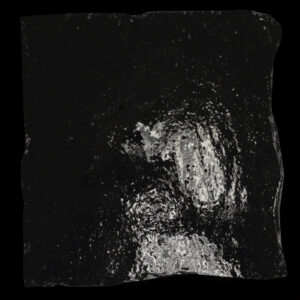 Mucosal Fascia