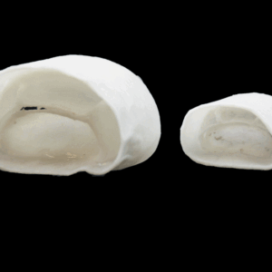 Mitral Valve