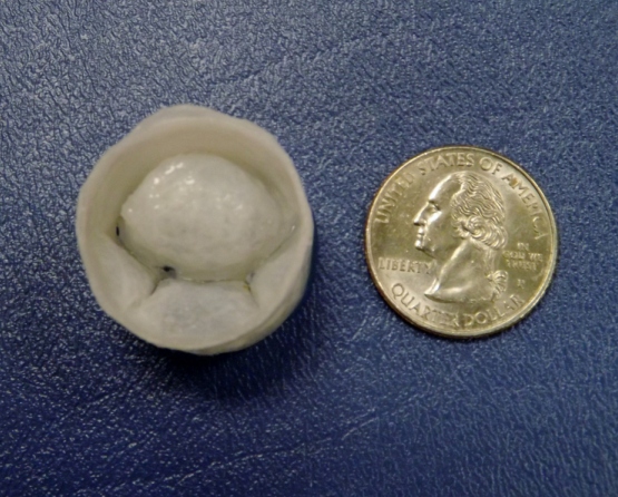 Mitral Valve - Image 6